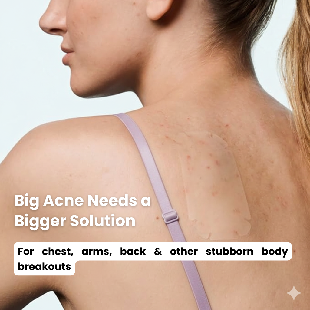 Hydrocolloid Roll - 16 ft